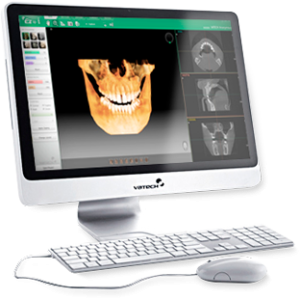 Ez3D-i – Vatech Mena