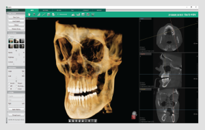Ez3D-i – Vatech Mena