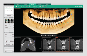 Ez3D-i – Vatech Mena