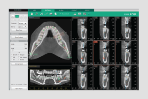 Ez3D-i – Vatech Mena