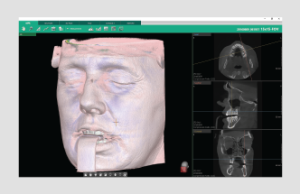 Ez3D-i – Vatech Mena